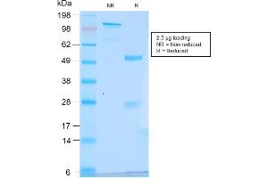 SDS-PAGE Analysis Purified pS2 Rabbit Recombinant Monoclonal Antibody (TFF1/2969R). (Recombinant TFF1 抗体  (AA 57-84))