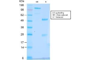 SDS-PAGE Analysis Purified pS2 Rabbit Recombinant Monoclonal Antibody (TFF1/2969R).