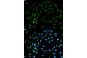 Immunofluorescence analysis of MCF-7 cells using TFPI antibody. (TFPI 抗体)