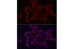 Immunofluorescence analysis of PC-12 cells using WDR45 Rabbit pAb (ABIN6133064, ABIN6150194, ABIN6150195 and ABIN6223490) at dilution of 1:100 (40x lens). (WDR45 抗体  (AA 1-360))