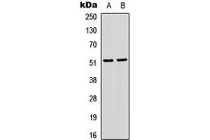 Western blot analysis of SRF (pS103) expression in HeLa (A), Jurkat (B) whole cell lysates. (SRF 抗体  (pSer103))