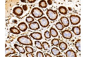 ABIN7093238 and ABIN7097250 at 1/100 staining Rat stomach tissue by IHC-P. (H2AFX 抗体  (acLys9))