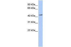 ACAA1 antibody used at 1 ug/ml to detect target protein. (ACAA1 抗体)
