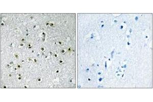 Immunohistochemistry (IHC) image for anti-Transcription Factor E3 (TFE3) (AA 101-150) antibody (ABIN2889417) (TFE3 抗体  (AA 101-150))