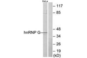 Western Blotting (WB) image for anti-RNA Binding Motif Protein, X-Linked (RBMX) (AA 6-55) antibody (ABIN2889468) (RBMX 抗体  (AA 6-55))