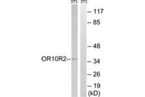 Western blot analysis of extracts from NIH-3T3 cells, using MAGEA5 Antibody. (MAGEA5 抗体  (AA 68-117))
