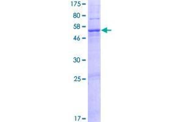 DNAJC22 Protein (AA 1-341) (GST tag)