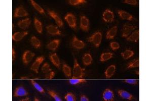 Immunofluorescence analysis of U-2 OS cells using GANAB Polyclonal Antibody at dilution of 1:100. (GANAB 抗体)
