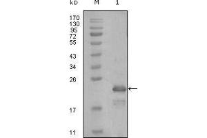 Western blot analysis using HAND1 mouse mAb against truncated Trx-HAND1 recombinant protein (1). (HAND1 抗体  (AA 90-190))