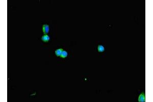 Immunofluorescent analysis of HepG2 cells using ABIN7150849 at dilution of 1:100 and Alexa Fluor 488-congugated AffiniPure Goat Anti-Rabbit IgG(H+L) (DNAAF3 抗体  (AA 1-209))