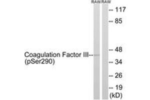 Western blot analysis of extracts from RAW264. (Tissue factor 抗体  (pSer290))