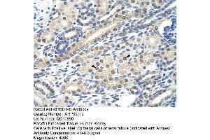 Immunohistochemistry (IHC) image for anti-Nucleus Accumbens Associated 1, BEN and BTB (POZ) Domain Containing (NACC1) (C-Term) antibody (ABIN2778437)