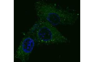 Immunofluorescence (IF) image for anti-Met Proto-Oncogene (MET) antibody (ABIN2995275) (c-MET 抗体)