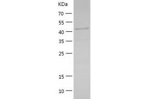 GABPB2 Protein (AA 1-395) (His tag)