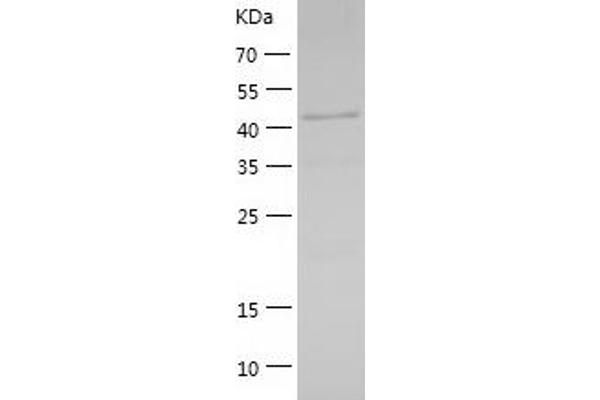 GABPB2 Protein (AA 1-395) (His tag)