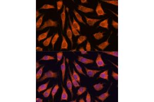 Immunofluorescence analysis of L929 cells using GOLPH3 antibody (ABIN6131711, ABIN6141272, ABIN6141273 and ABIN6216996) at dilution of 1:100. (GOLPH3 抗体  (AA 1-298))