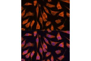 Immunofluorescence analysis of L929 cells using GOLPH3 antibody (ABIN6131711, ABIN6141272, ABIN6141273 and ABIN6216996) at dilution of 1:100. (GOLPH3 抗体  (AA 1-298))