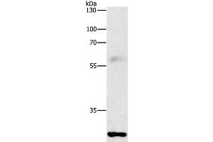 Western Blot analysis of Mouse lung tissue using FGF2 Polyclonal Antibody at dilution of 1:1000