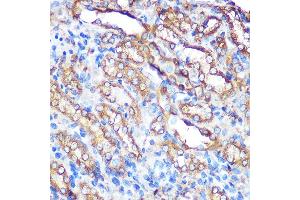 Immunohistochemistry of paraffin-embedded rat kidney using Bcl-XL Rabbit pAb (ABIN3020685, ABIN3020686, ABIN1512625 and ABIN6213668) at dilution of 1:100 (40x lens). (BCL2L1 抗体  (AA 1-120))