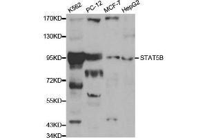 Western blot analysis of extracts of various cell lines, using STAT5B antibody. (STAT5B 抗体  (AA 40-280))