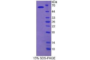 SDS-PAGE analysis of Rat TDP1 Protein. (TDP1 蛋白)