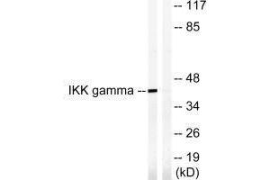 Western blot analysis of extracts from HepG2 cells, treated with Anisomycin (0.