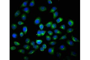 Immunofluorescence staining of A549 cells with ABIN7144072 at 1:116, counter-stained with DAPI.