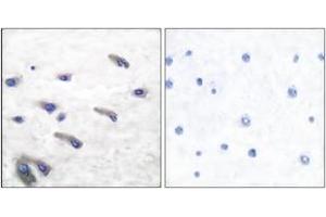Immunohistochemistry analysis of paraffin-embedded human brain, using PDGF Receptor beta (Phospho-Tyr751) Antibody. (PDGFRB 抗体  (pTyr751))