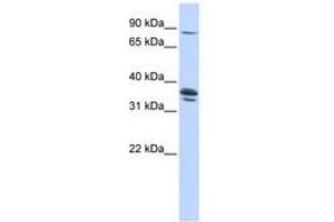 Image no. 1 for anti-Solute Carrier Organic Anion Transporter Family, Member 3A1 (SLCO3A1) (AA 360-409) antibody (ABIN6740849) (Solute Carrier Organic Anion Transporter Family, Member 3A1 (SLCO3A1) (AA 360-409) 抗体)