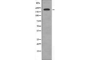 Western Blotting (WB) image for anti-Collagen, Type V, alpha 1 (COL5A1) (Internal Region) antibody (ABIN6257109)