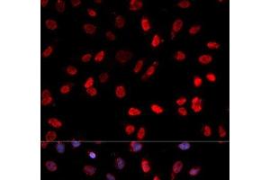 Immunofluorescence analysis of MCF-7 cells using Phospho-ATF2(T71) Polyclonal Antibody (ATF2 抗体  (pThr71))