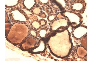 Immunohistochemistry (IHC) image for anti-Solute Carrier Family 5 (Sodium/iodide Cotransporter), Member 5 (SLC5A5) (AA 468-643) antibody (HRP) (ABIN2484442)