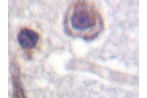 Immunohistochemistry analyzes of CaR antibody in paraffin-embedded human brain tissue. (CASR 抗体)
