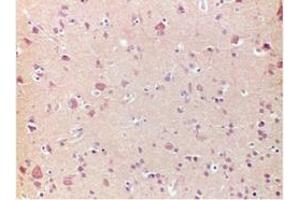 Immunohistochemistry (IHC) image for anti-Frataxin (FXN) antibody (ABIN781667) (Frataxin 抗体)