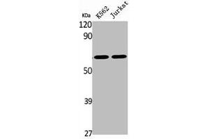 Western Blot analysis of K562 Jurkat cells using BOCT Polyclonal Antibody (SLC22A17 抗体  (Internal Region))