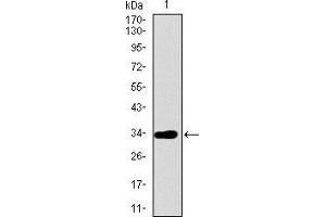 Western blot analysis using ABCG5 mAb against human ABCG5 recombinant protein. (ABCG5 抗体  (AA 306-367))