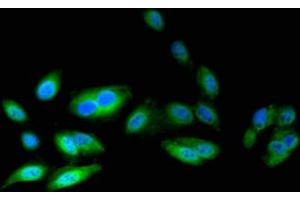 Immunofluorescent analysis of Hela cells using ABIN7145576 at dilution of 1:100 and Alexa Fluor 488-congugated AffiniPure Goat Anti-Rabbit IgG(H+L) (ATIC 抗体  (AA 301-592))