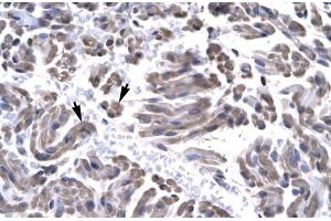 Immunohistochemistry (IHC) image for anti-General Transcription Factor IIH, Polypeptide 3, 34kD (GTF2H3) (N-Term) antibody (ABIN2777299)