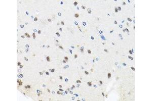 Immunohistochemistry (Paraffin-embedded Sections) (IHC (p)) image for anti-PRP8 Pre-mRNA Processing Factor 8 (PRPF8) antibody (ABIN7261922)