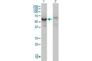 Western Blotting (WB) image for anti-DEAD (Asp-Glu-Ala-Asp) Box Polypeptide 56 (DDX56) (AA 450-548) antibody (ABIN599259) (DDX56 抗体  (AA 450-548))