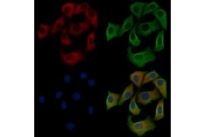 ABIN6258935 and ABIN6275451 staining Hela cells by IF/ICC. (G3BP2 抗体  (C-Term))