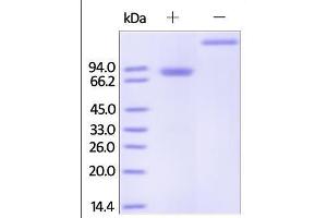 Human Osteoprotegerin, Fc Tag on SDS-PAGE under reducing (R) and no-reducing (NR) conditions.