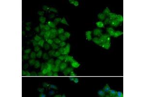 Immunofluorescence analysis of HeLa cells using PSMB10 Polyclonal Antibody (PSMB10 抗体)