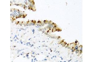 Immunohistochemistry of paraffin-embedded Mouse lung using BMP4 Polyclonal Antibody at dilution of 1:100 (40x lens). (BMP4 抗体)