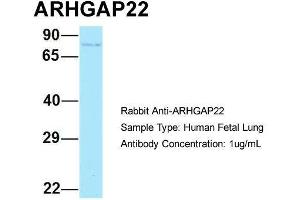 Host: Rabbit  Target Name: ARHGAP22  Sample Tissue: Human Fetal Lung  Antibody Dilution: 1.