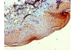 Immunohistochemistry of paraffin-embedded human skin tissue using ABIN7145746 at dilution of 1:100 (BCAT2 抗体  (AA 28-392))
