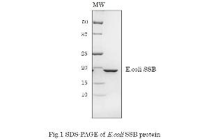 Western Blotting (WB) image for Sjogren Syndrome Antigen B (SSB) (Active) protein (ABIN2452175)