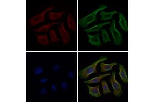 ABIN7094788 and ABIN7098839 staining HepG2 cells by IF/ICC. (GLDN 抗体  (N-Term))