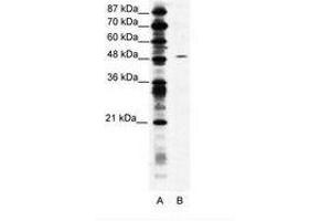 Image no. 1 for anti-Suppressor of Variegation 4-20 Homolog 1 (SUV420H1) (AA 763-812) antibody (ABIN203167) (SUV420H1 抗体  (AA 763-812))