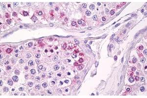 Anti-USP13 antibody IHC staining of human testis. (USP13 抗体  (AA 500-550))